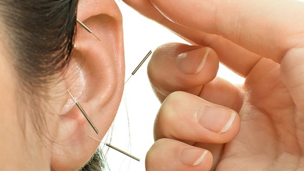 Can Acupuncture Relieve Tinnitus Symptoms?