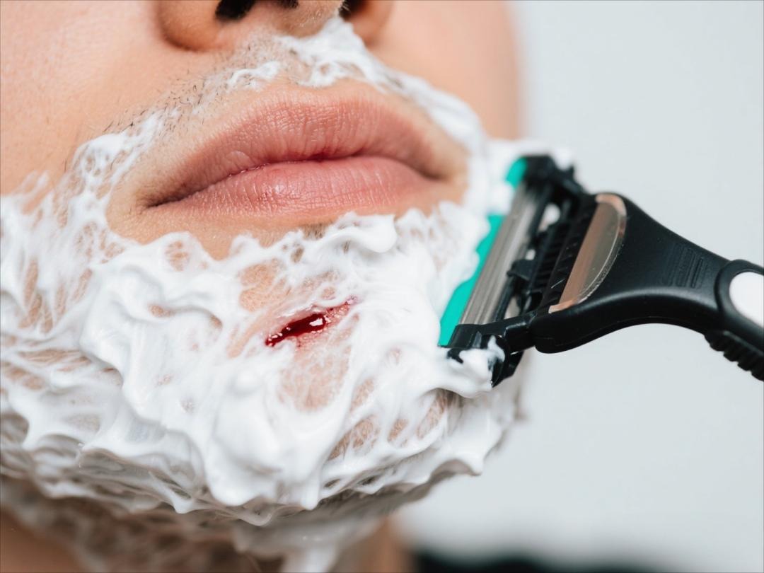 How Long Do Razor Cuts Take to Heal? Tips to Speed Up Recovery and Avoid Scars